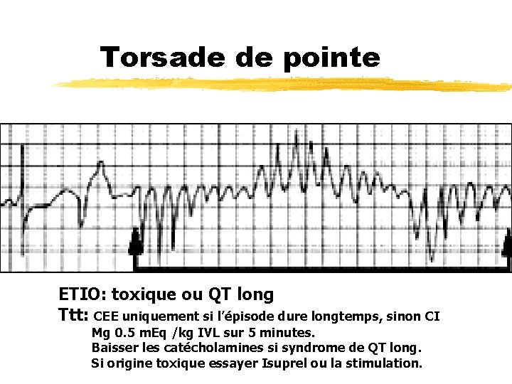 Torsade de pointe ETIO: toxique ou QT long Ttt: CEE uniquement si l’épisode dure