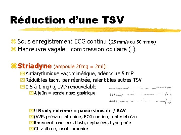 Réduction d’une TSV z Sous enregistrement ECG continu (25 mm/s ou 50 mm/s) z