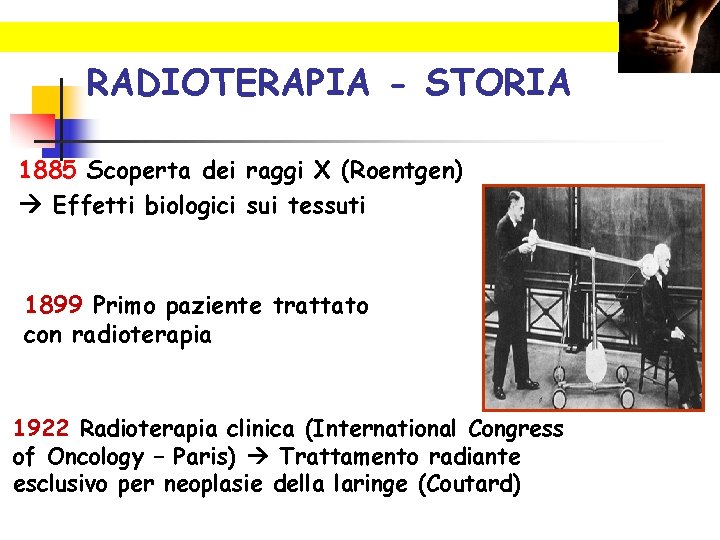 RADIOTERAPIA - STORIA 1885 Scoperta dei raggi X (Roentgen) Effetti biologici sui tessuti 1899