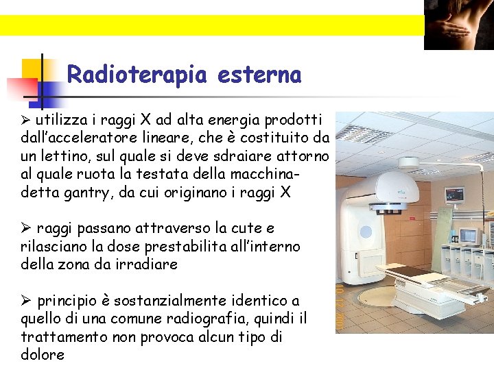 Radioterapia esterna Ø utilizza i raggi X ad alta energia prodotti dall’acceleratore lineare, che