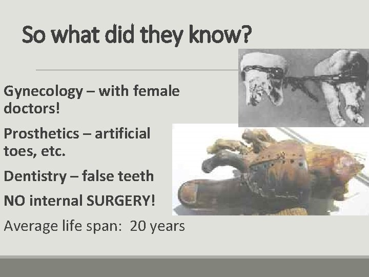 So what did they know? Gynecology – with female doctors! Prosthetics – artificial toes,