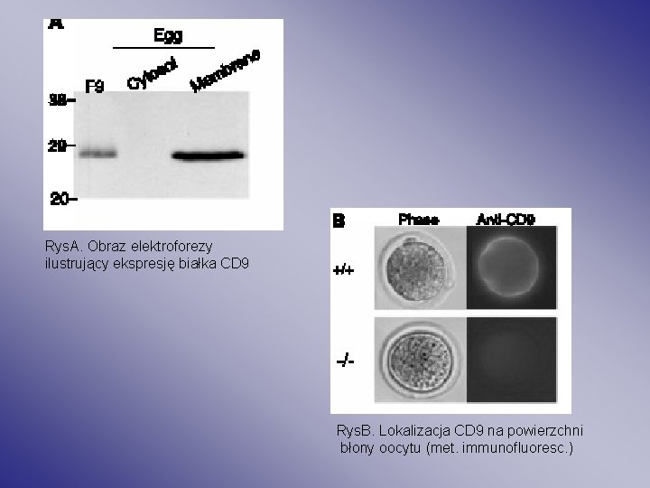 Rys. A. Obraz elektroforezy ilustrujący ekspresję białka CD 9 Rys. B. Lokalizacja CD 9