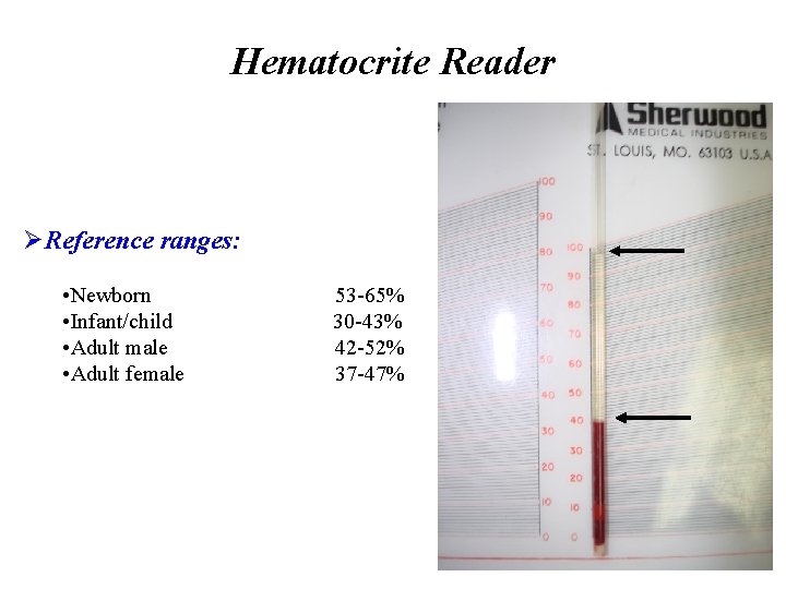 Hematocrite Reader ØReference ranges: • Newborn • Infant/child • Adult male • Adult female