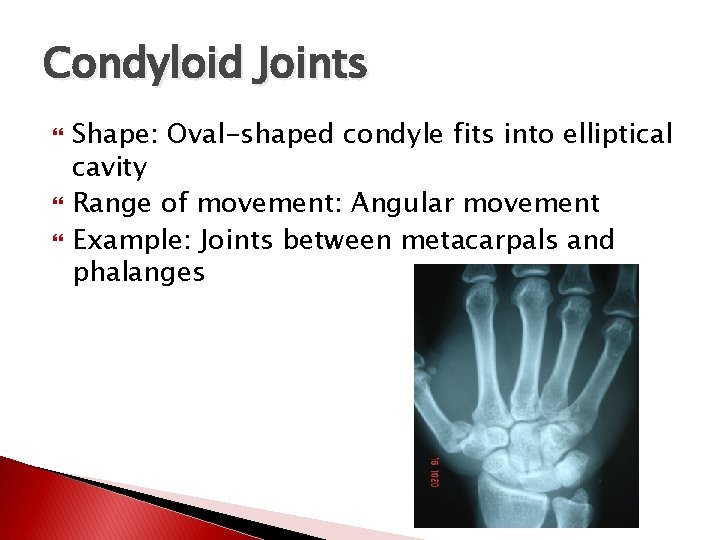 Condyloid Joints Shape: Oval-shaped condyle fits into elliptical cavity Range of movement: Angular movement