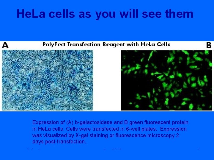 He. La cells as you will see them Expression of (A) b-galactosidase and B