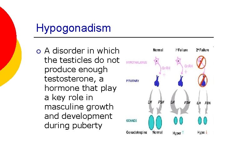 Hypogonadism ¡ A disorder in which the testicles do not produce enough testosterone, a