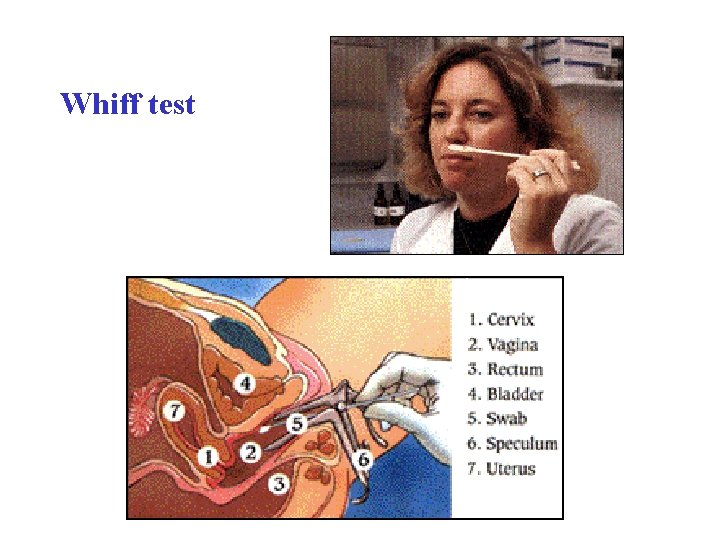 Whiff test 