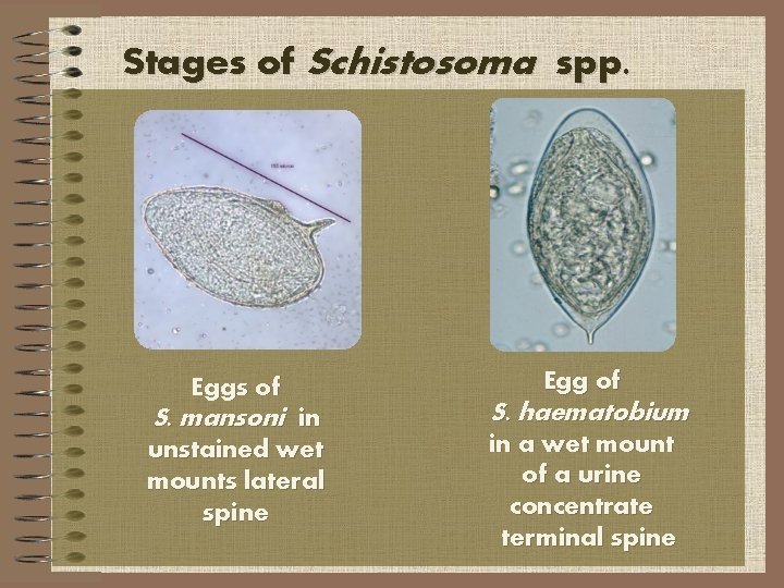 Stages of Schistosoma spp. Eggs of S. mansoni in unstained wet mounts lateral spine