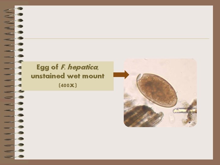 Egg of F. hepatica, unstained wet mount (400 x) 
