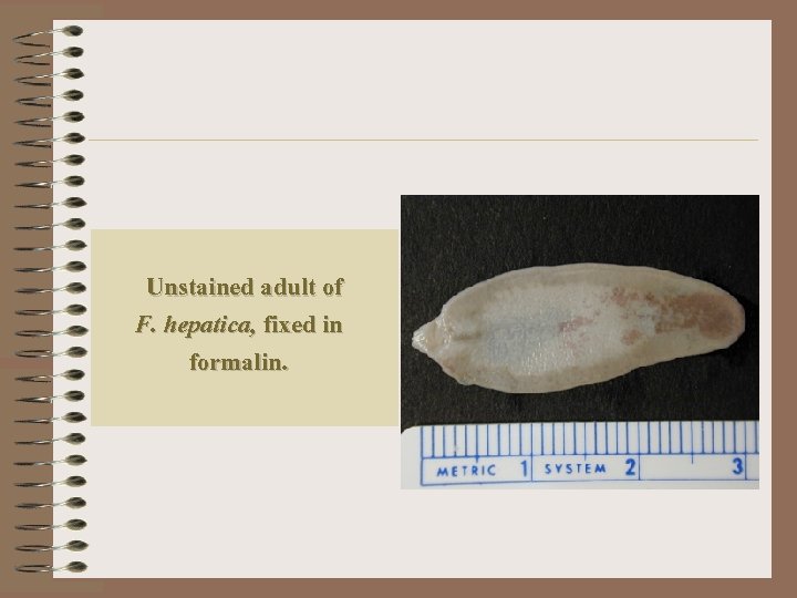 Unstained adult of F. hepatica, fixed in formalin. 