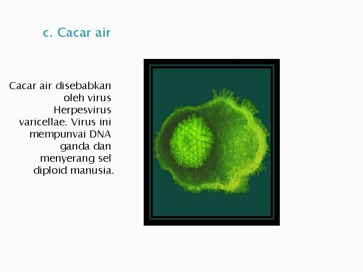 c. Cacar air disebabkan oleh virus Herpesvirus varicellae. Virus ini mempunvai DNA ganda dan c. Cacar air disebabkan oleh virus Herpesvirus varicellae. Virus ini mempunvai DNA ganda dan