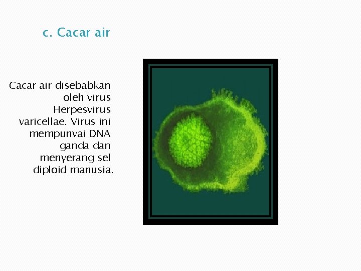 c. Cacar air disebabkan oleh virus Herpesvirus varicellae. Virus ini mempunvai DNA ganda dan