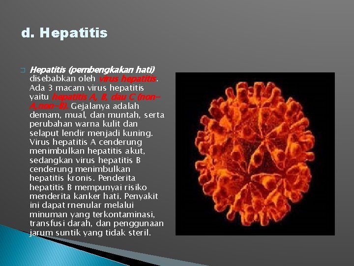 d. Hepatitis � Hepatitis (pembengkakan hati) disebabkan oleh virus hepatitis. Ada 3 macam virus d. Hepatitis � Hepatitis (pembengkakan hati) disebabkan oleh virus hepatitis. Ada 3 macam virus
