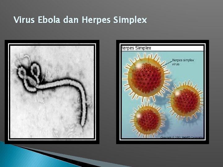 Virus Ebola dan Herpes Simplex 