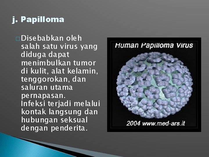 j. Papilloma � Disebabkan oleh salah satu virus yang diduga dapat menimbulkan tumor di