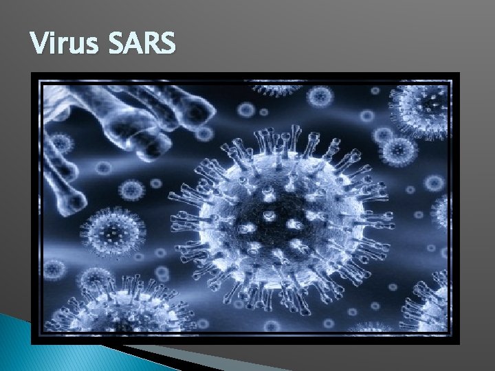 Virus SARS Virus SARS