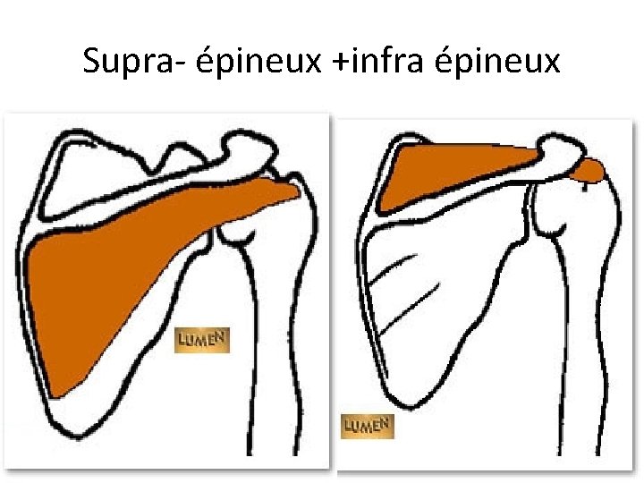 Supra- épineux +infra épineux Supra- épineux +infra épineux