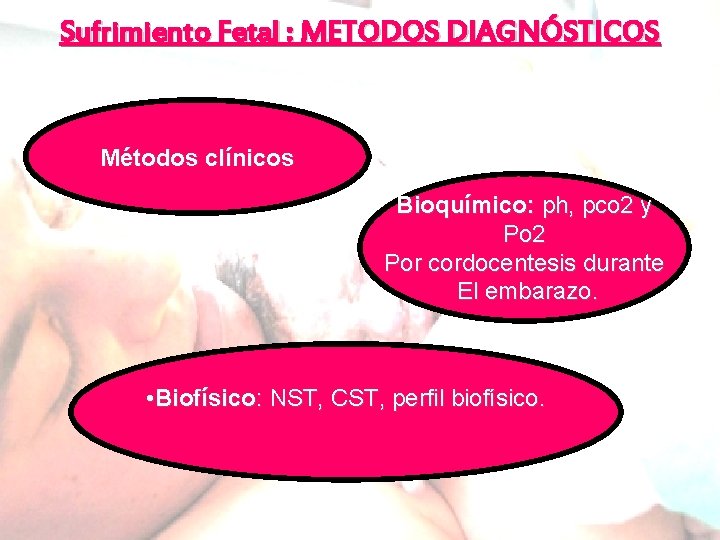 Sufrimiento Fetal : METODOS DIAGNÓSTICOS Métodos clínicos Bioquímico: ph, pco 2 y Po 2 Sufrimiento Fetal : METODOS DIAGNÓSTICOS Métodos clínicos Bioquímico: ph, pco 2 y Po 2