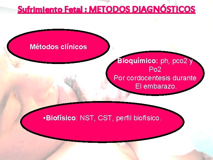 Sufrimiento Fetal : METODOS DIAGNÓSTICOS Métodos clínicos Bioquímico: ph, pco 2 y Po 2