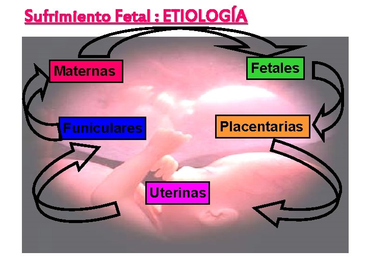 Sufrimiento Fetal : ETIOLOGÍA Fetales Maternas Placentarias Funiculares Uterinas 