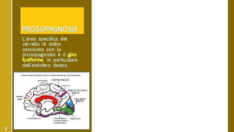 PROSOPAGNOSIA L’area specifica del cervello di solito associata con la prosopagnosia è il giro