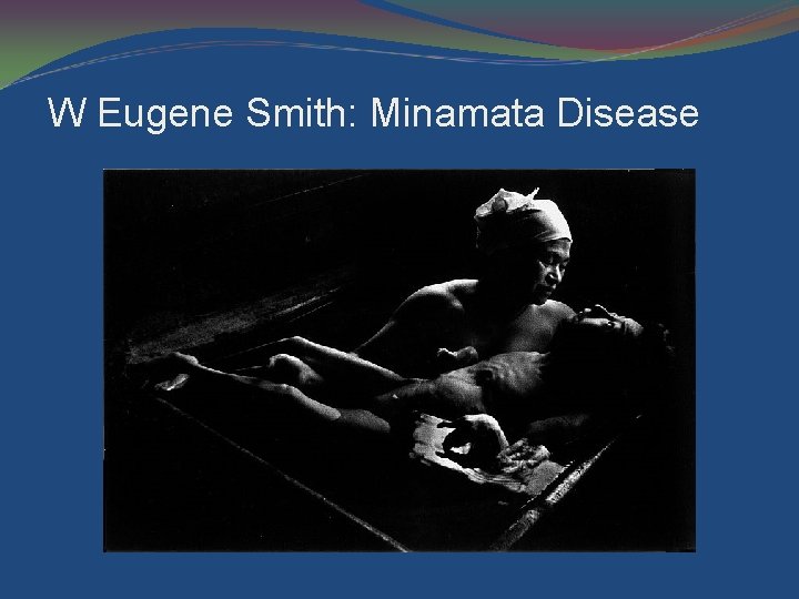 W Eugene Smith: Minamata Disease 