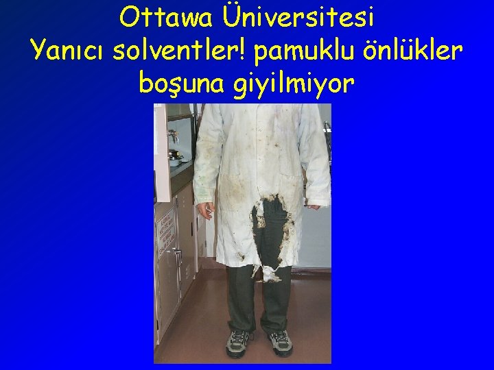 Ottawa Üniversitesi Yanıcı solventler! pamuklu önlükler boşuna giyilmiyor 