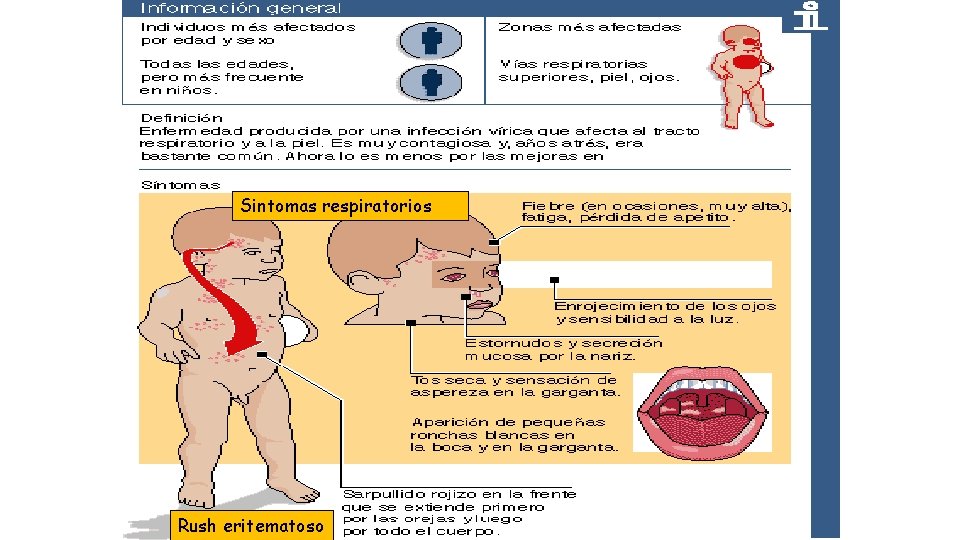 Sintomas respiratorios Rush eritematoso 