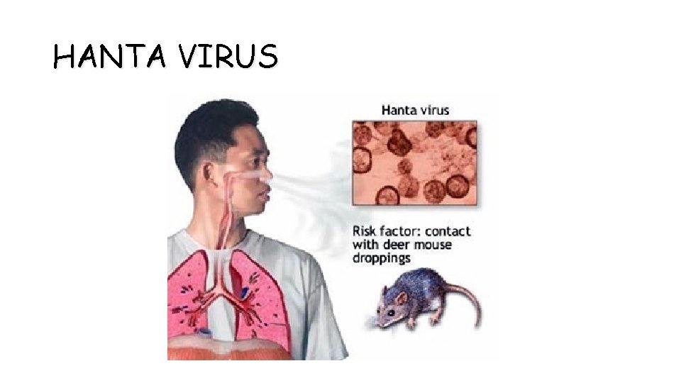 HANTA VIRUS 