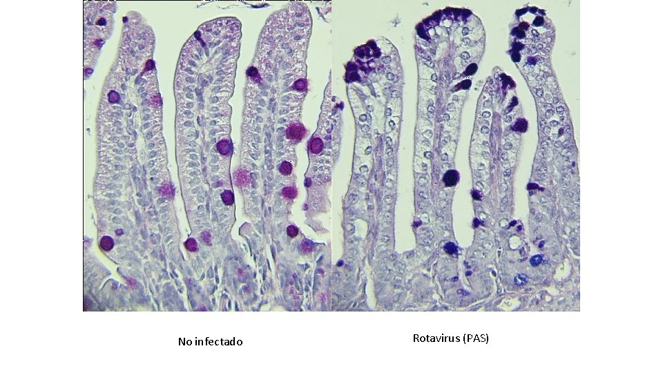 No infectado Rotavirus (PAS) 