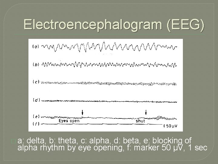 Electroencephalogram (EEG) � a: delta, b: theta, c: alpha, d: beta, e: blocking of Electroencephalogram (EEG) � a: delta, b: theta, c: alpha, d: beta, e: blocking of