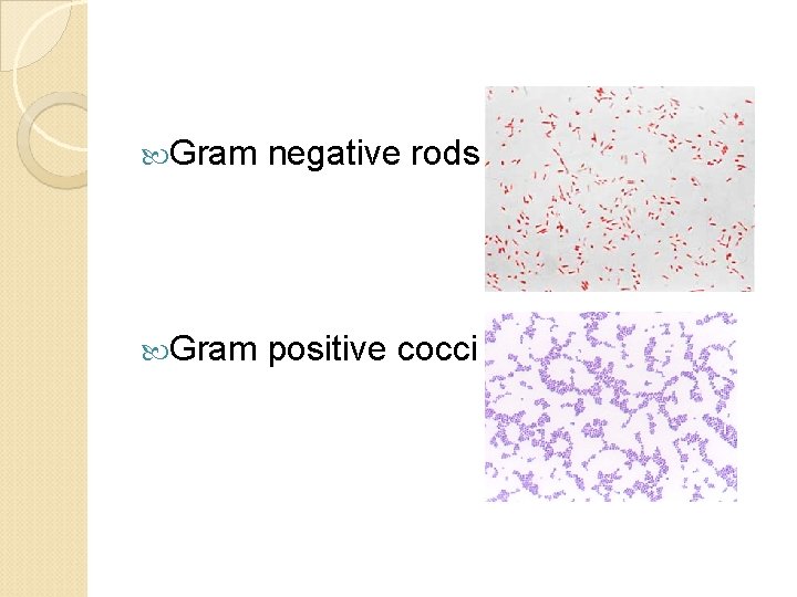  Gram negative rods Gram positive cocci 