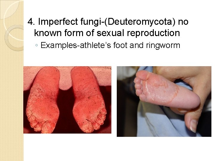 4. Imperfect fungi-(Deuteromycota) no known form of sexual reproduction ◦ Examples-athlete’s foot and ringworm