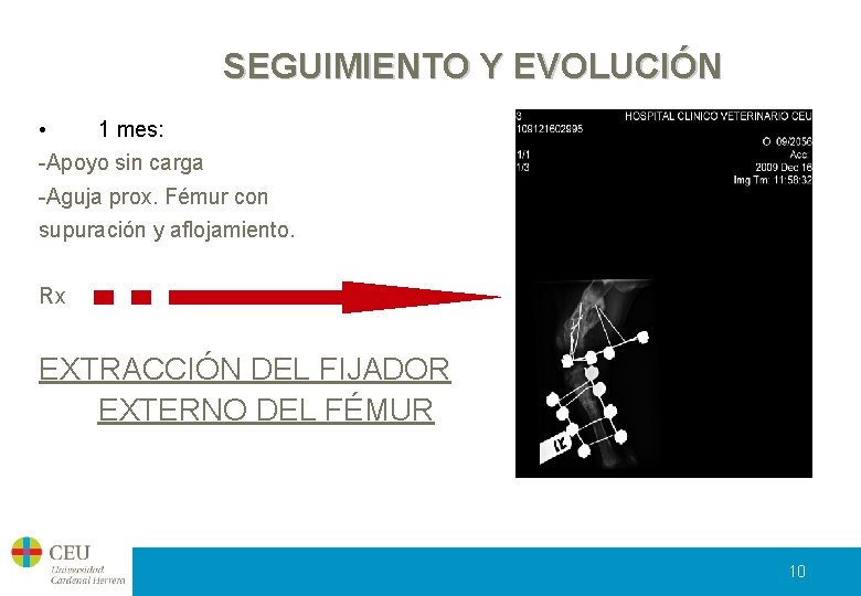 SEGUIMIENTO Y EVOLUCIÓN • 1 mes: -Apoyo sin carga -Aguja prox. Fémur con supuración