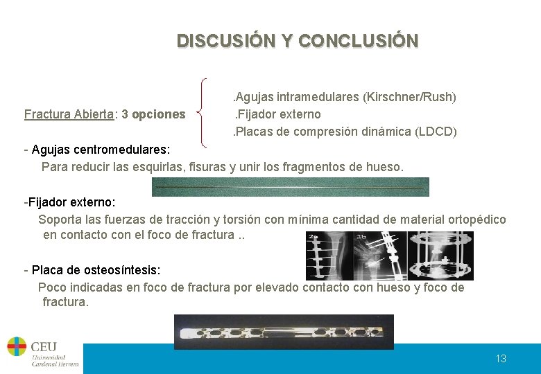 DISCUSIÓN Y CONCLUSIÓN Fractura Abierta: 3 opciones . Agujas intramedulares (Kirschner/Rush). Fijador externo. Placas