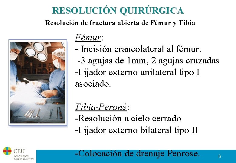 RESOLUCIÓN QUIRÚRGICA Resolución de fractura abierta de Fémur y Tibia Fémur: - Incisión craneolateral