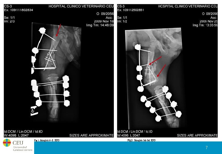 Fig 1: Imagen v-d EPD Fig 2: Imagen lat-lat EPD 7 