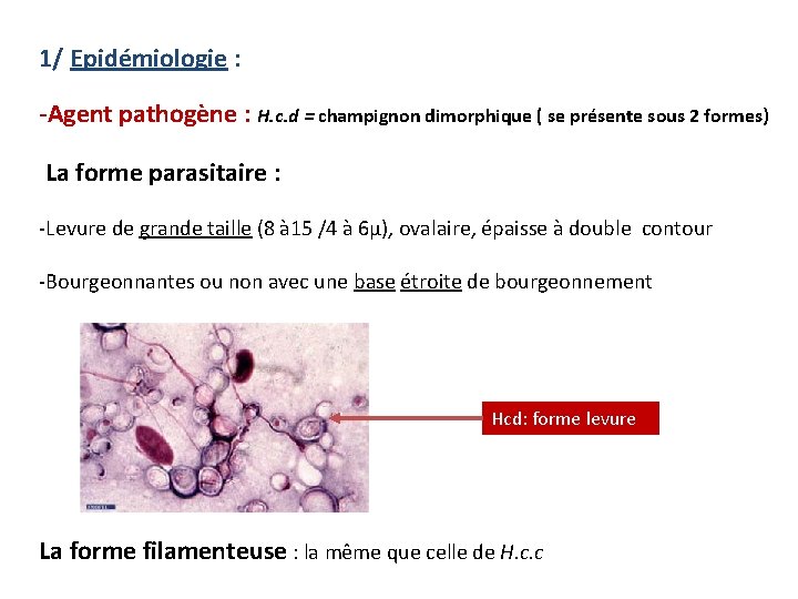 1/ Epidémiologie : -Agent pathogène : H. c. d = champignon dimorphique ( se