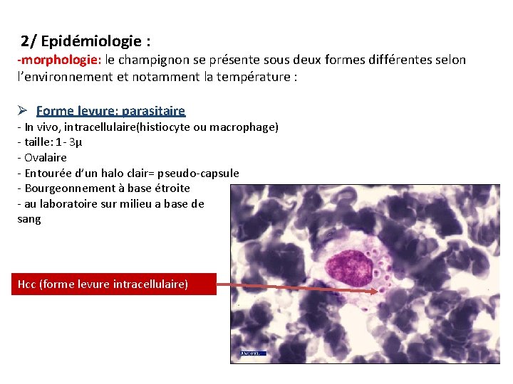  2/ Epidémiologie : -morphologie: le champignon se présente sous deux formes différentes selon