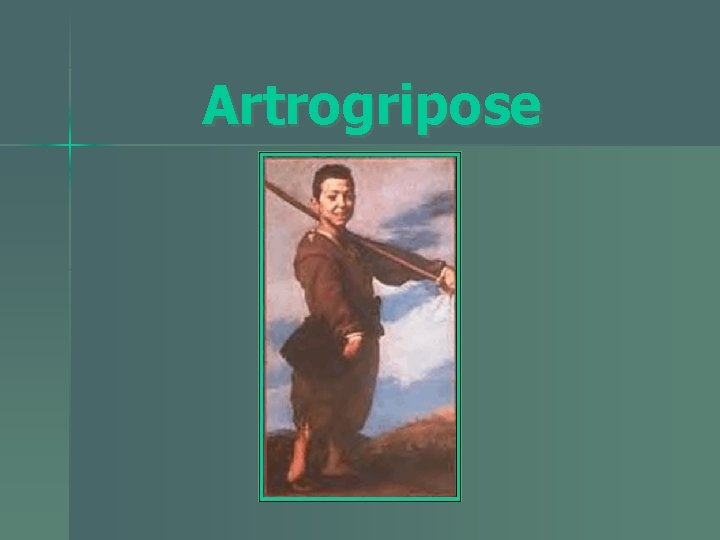 Artrogripose 