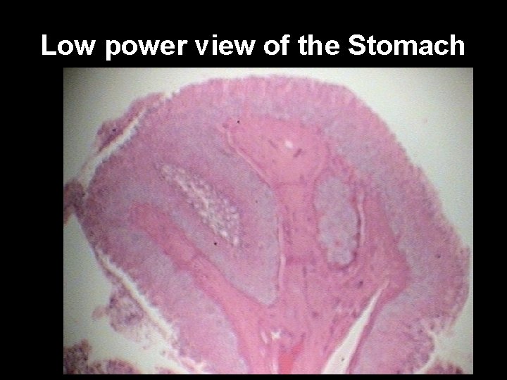 Low power view of the Stomach 