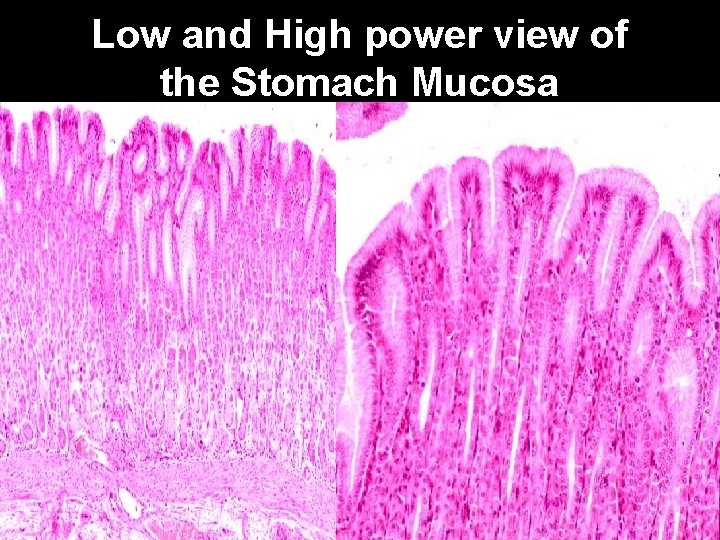 Low and High power view of the Stomach Mucosa 