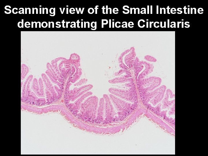 Scanning view of the Small Intestine demonstrating Plicae Circularis 