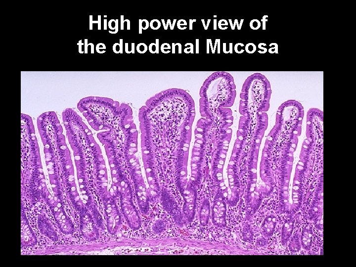High power view of the duodenal Mucosa 