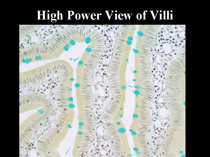 High Power View of Villi 