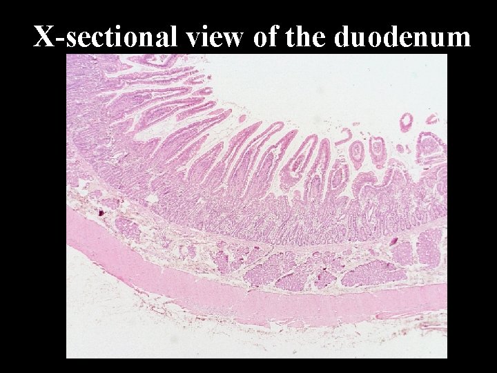 X-sectional view of the duodenum 