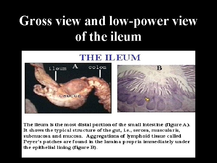 Gross view and low-power view of the ileum 