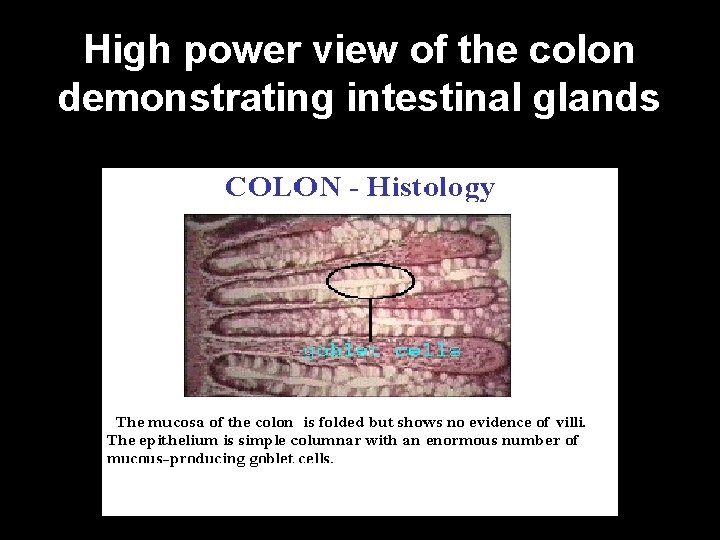 High power view of the colon demonstrating intestinal glands 
