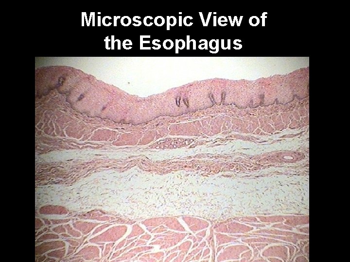 Microscopic View of the Esophagus 