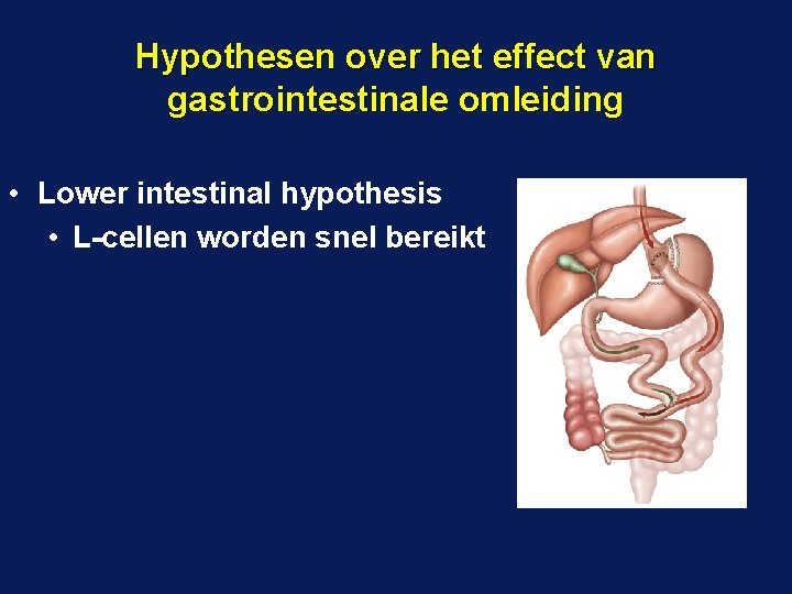 Hypothesen over het effect van gastrointestinale omleiding • Lower intestinal hypothesis • L-cellen worden